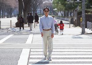 リフトアップが上手い世田谷のクリニック